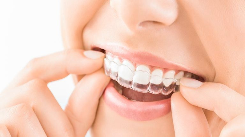 Why Adult Orthodontics Is Important